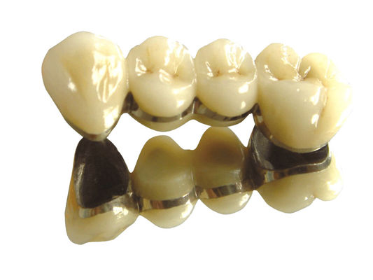 شراء لون الأسنان الكوبالت الكروم التاج PFM الأسنان النبيلة العالية PFM online manufacture