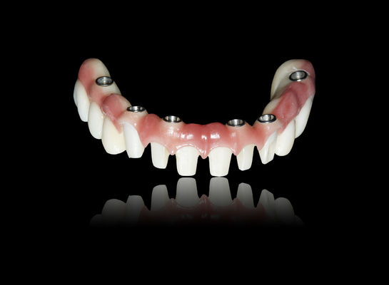 شراء كل شيء على X زرع جسر الزركونيا زرع جسر التاج المظهر الطبيعي online manufacture
