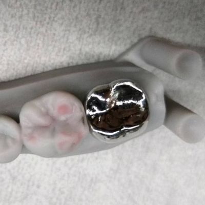 شراء التاج المعدني الكامل والجسر الدقة العالية التاج الفضي المؤقت online manufacture
