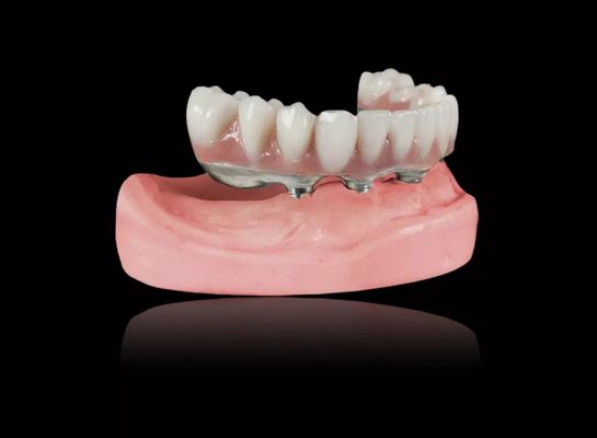 شراء زرع تيتانيوم بار أسنان قابلة للإزالة سبائك التيتانيوم زرع تيتانيوم بار أسنان زائد online manufacture