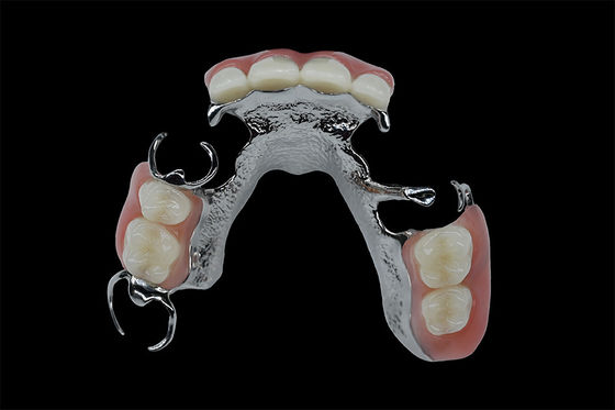 شراء أسنان قابلة للتخصيص قابلة للإزالة إطار التيتانيوم إطار معدني أسنان online manufacture