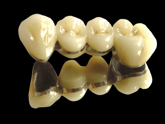 شراء زرع جسر معدني ثمين جسر التاج مقاوم للاستعمال حسب الطلب online manufacture