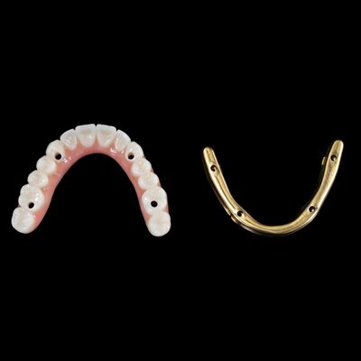 شراء تخصيص زراعة أسنان هجينة أسنان هجينة مع شريط التيتانيوم online manufacture