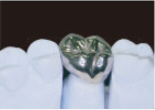 التاج المعدني الكامل والجسر الدقة العالية التاج الفضي المؤقت